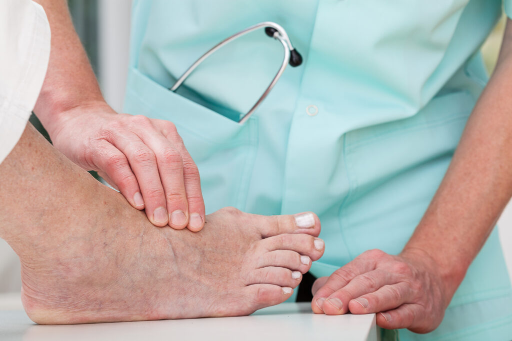 Provider touching top of patient's foot to detect pulse