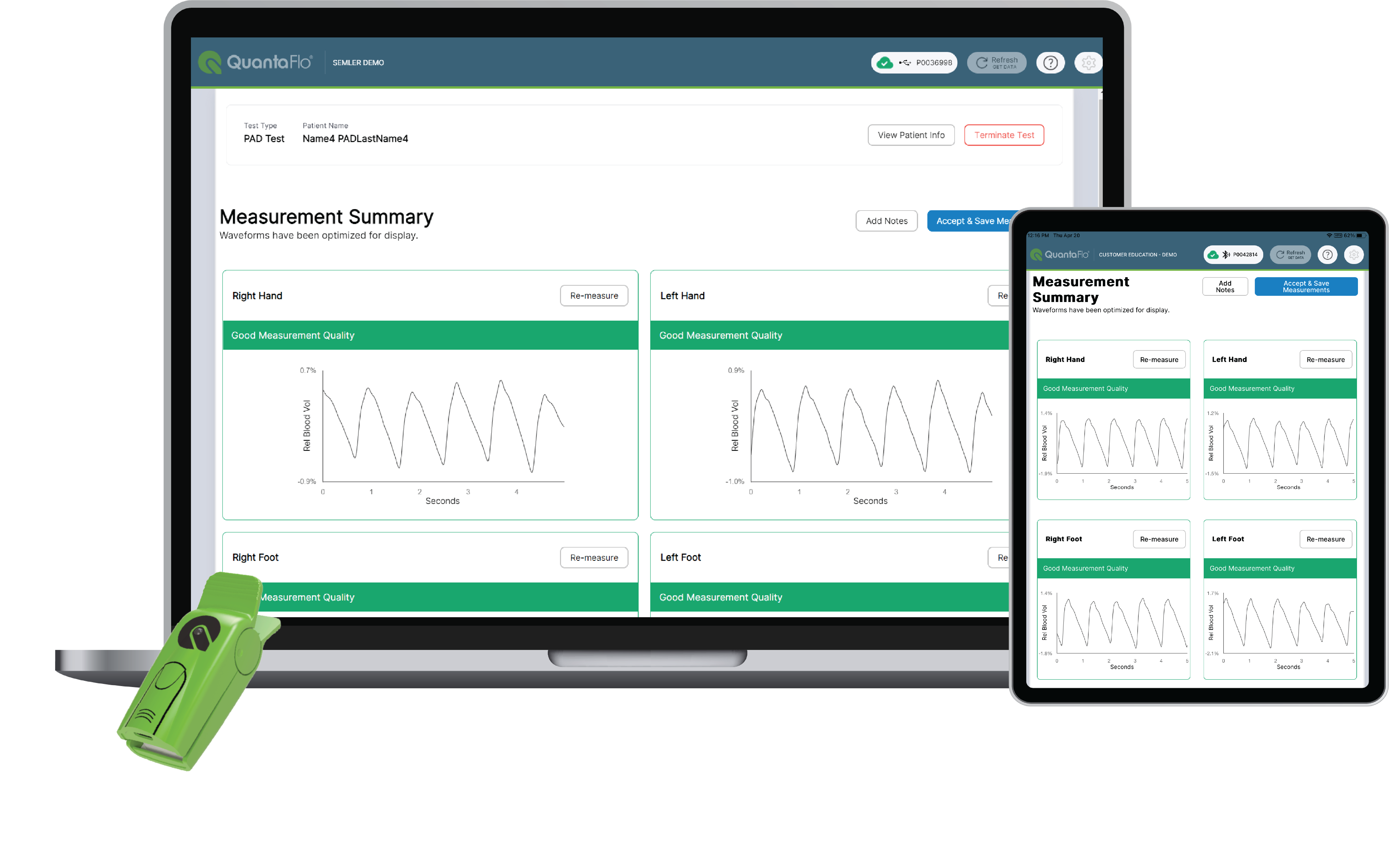 A laptop and tablet showing QuantaFlo test results with a sensor resting against the laptop